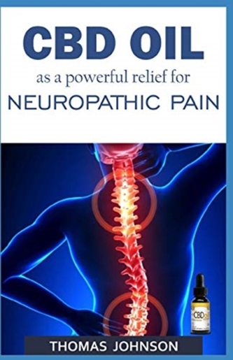 CBD OIL AS A POWERFUL RELIEF FOR NEUROPA