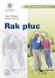 Rak płuc - Pokonać raka