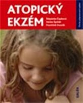 Atopický ekzém