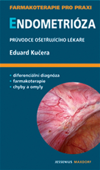 Endometrióza Endometrióza