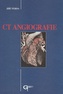 CT Angiografie