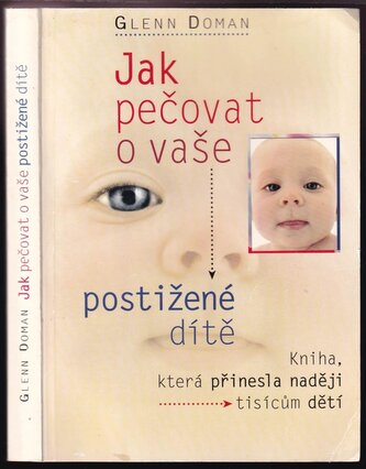 Jak pečovat o vaše postižené dítě