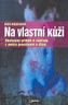 Na vlastní kůži