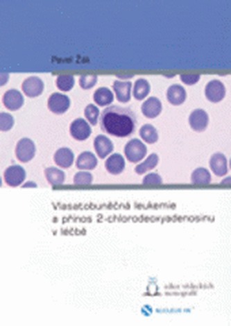 Vlasatobuněčná leukemie a přínos 2-chlorodeoxyadenosinu vléčbě