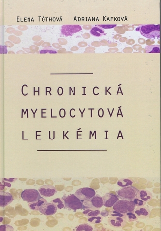 Chronická myelocytová leukémia Chronická myelocytová leukémia