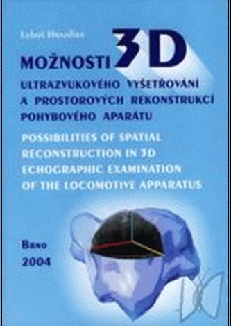 Možnosti 3D ultrazvukového vyšetřování a prostorových rekonstrukcí pohybového aparátu  