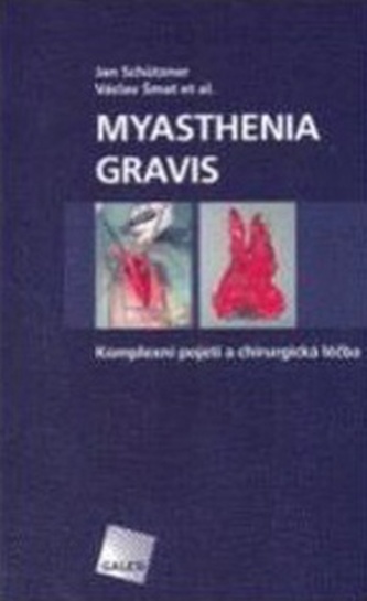 Myasthenia gravis