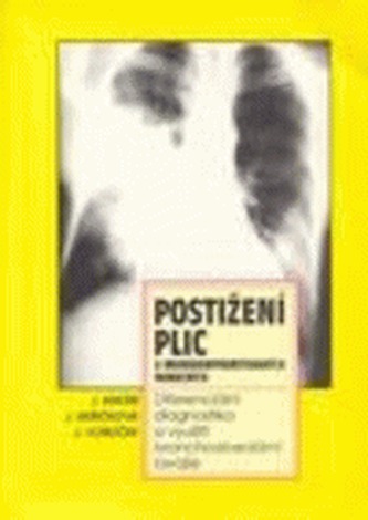 Postižení plic u imunokompromitovaných nemocných : diferenciální diagnostika a využití bronchoaveolární laváže