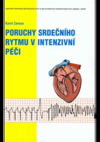 Poruchy srdečního rytmu v intenzivní péči