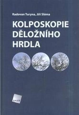 Kolposkopie děložního hrdla Kolposkopie děložního hrdla