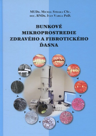 Bunkové mikroprostredie zdravého a fibrotického ďasna Bunkové mikroprostredie zdravého a fibrotického ďasna
