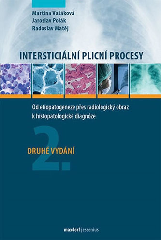 Intersticiální plicní procesy - Od etiopatogeneze přes radiologický obraz k histopatologické diagnóze Intersticiální plicní procesy - Od etiopatogeneze přes radiologický obraz k histopatologické diagnóze
