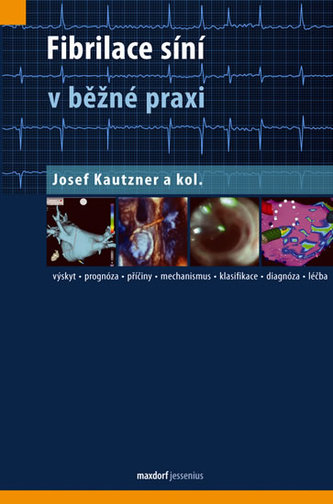 Fibrilace síní v běžné praxi Fibrilace síní v běžné praxi