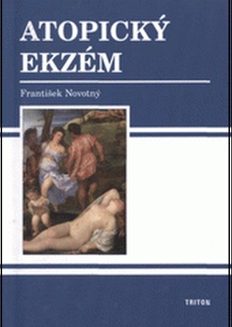 Atopický ekzém