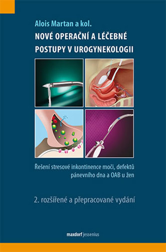 Nové operační postupy v urogynekologii - Řešení stresové inkontinence moči a defektů pánevního dna u žen Nové operační postupy v urogynekologii - Řešení stresové inkontinence moči a defektů pánevního dna u žen