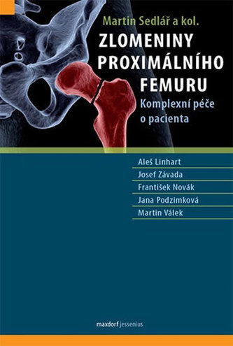 Zlomeniny proximálního femuru - Komplexní péče o pacienta Zlomeniny proximálního femuru - Komplexní péče o pacienta