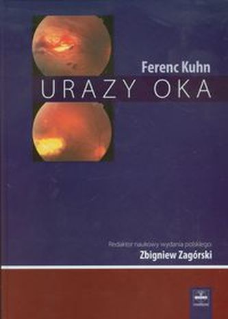 Urazy oka