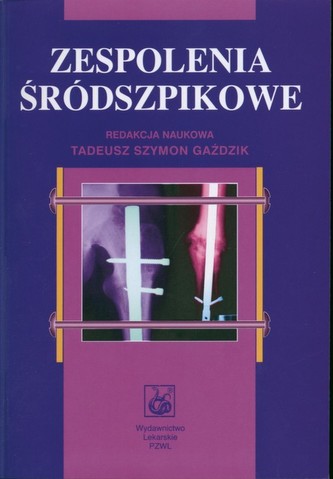 Zespolenia śródszpikowe