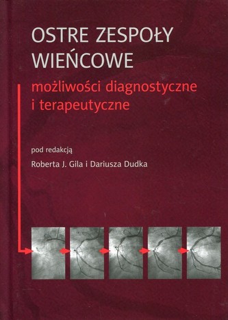 Ostre zespoły wieńcowe Możliwości diagnostyczne i terapeutyczne Ostre zespoły wieńcowe Możliwości diagnostyczne i terapeutyczne