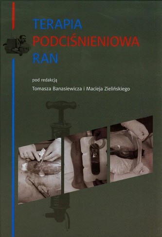Terapia podciśnieniowa ran Terapia podciśnieniowa ran