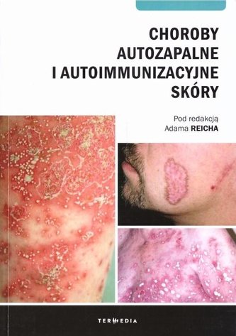 Choroby autozapalne i autoimmunizacyjne skóry Choroby autozapalne i autoimmunizacyjne skóry