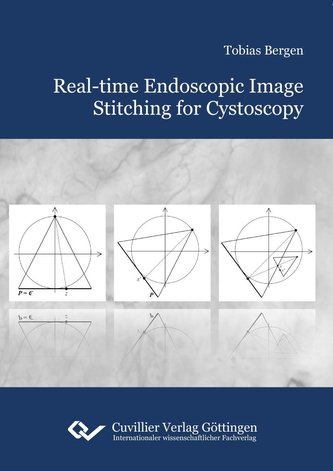 Real-time Endoscopic Image Stitching for Cystoscopy