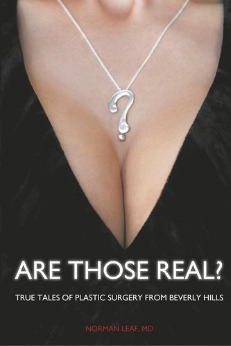 Are Those Real?