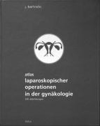 Atlas laparoskopischer Operationen in der Gynäkologie