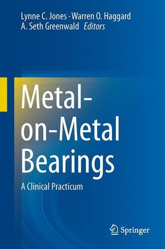 Metal-on-Metal Bearings