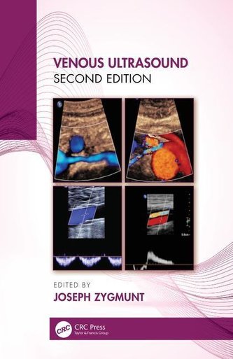 Practical Phlebology: Venous Ultrasound