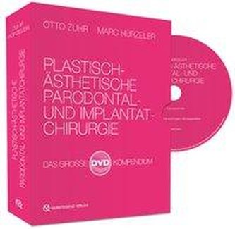 Plastisch-Ästhetische Parodontal- und Implantatchirurgie