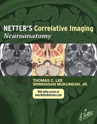 Netters Correlative Imaging: Neuroanatomy