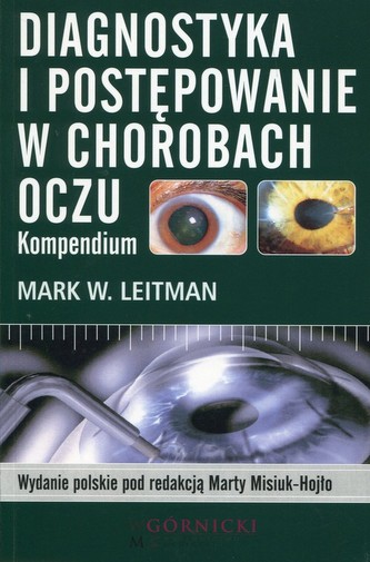 Diagnostyka i postępowanie w chorobach oczu Diagnostyka i postępowanie w chorobach oczu
