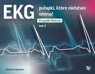 EKG. Pułapki, które niełatwo ominąć T.2