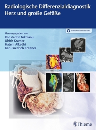 Radiologische Differenzialdiagnostik Herz und große Gefäße, m. 1 Buch, m. 1 E-Book Radiologische Differenzialdiagnostik Herz und große Gefäße, m. 1 Buch, m. 1 E-Book