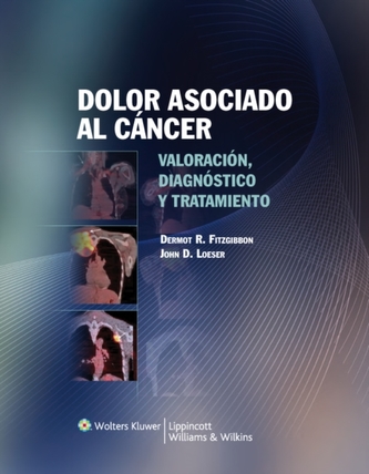 Dolor asociado al cancer
