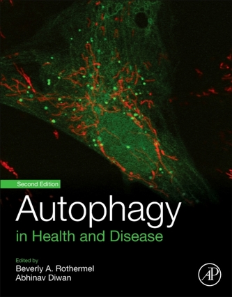 Autophagy in Health and Disease