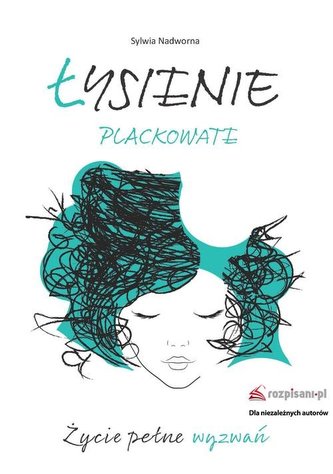 Łysienie plackowate