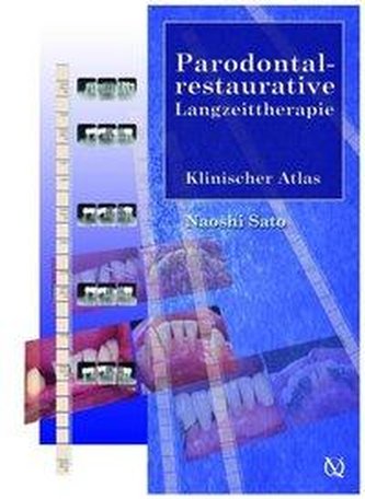 Parodontal-restaurative Langzeittherapie