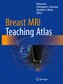 Breast MRI Teaching Atlas
