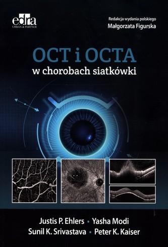 OCT i OCTA w chorobach siatkówki OCT i OCTA w chorobach siatkówki