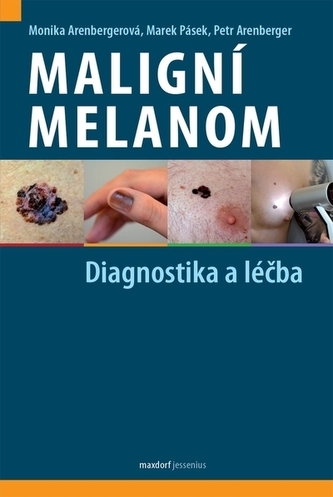 Maligní melanom - Diagnostika a léčba Maligní melanom - Diagnostika a léčba