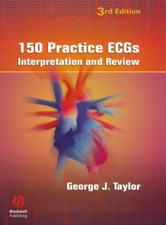 150 Practice ECGs - Interpretation and Review 3e