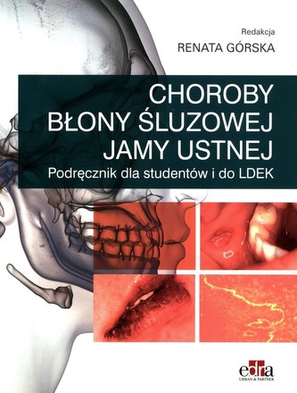 Choroby błony śluzowej jamy ustnej