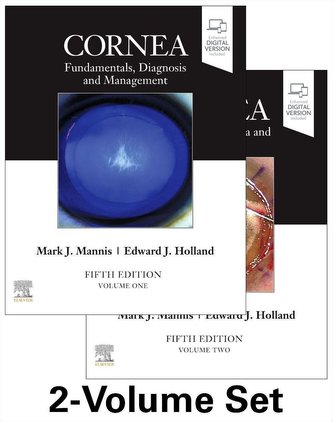 Cornea, 2-Volume Set